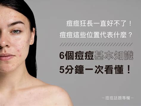 女生長痘痘|痘痘一直好不了？痘痘位置代表什麼？醫師2招治療痘。